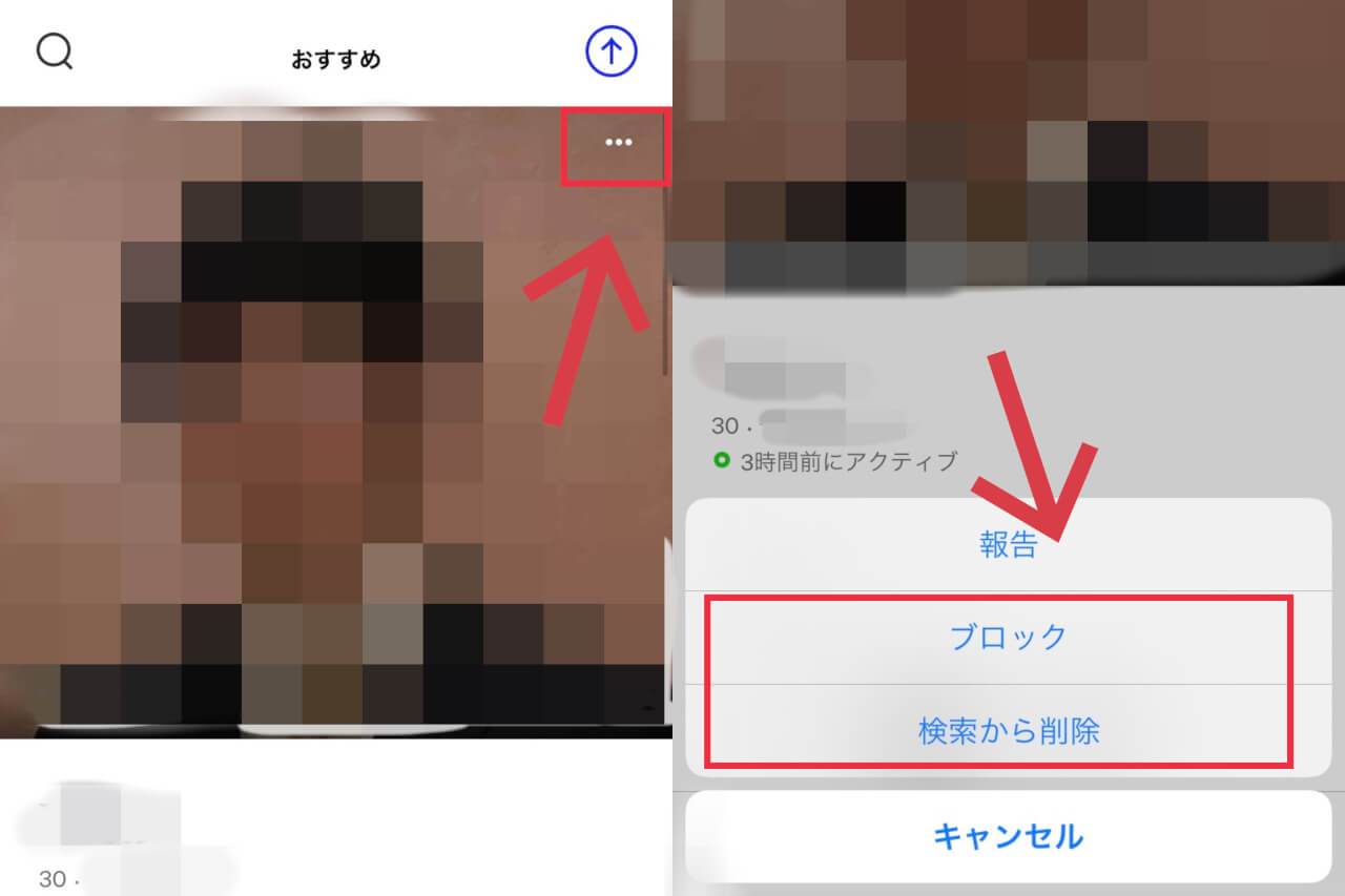 Matchのブロック・非表示